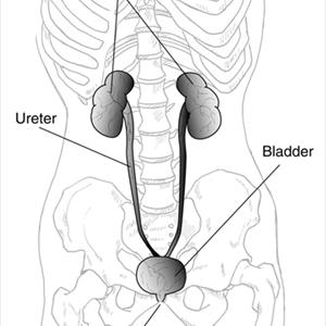 Uti Home Remedy - Guidelines For The Prevention Of Urinary Tract Infection UTI