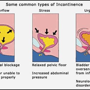 Uti Infection Symptoms In Men - Anatomy Of The Human Urinary Tract